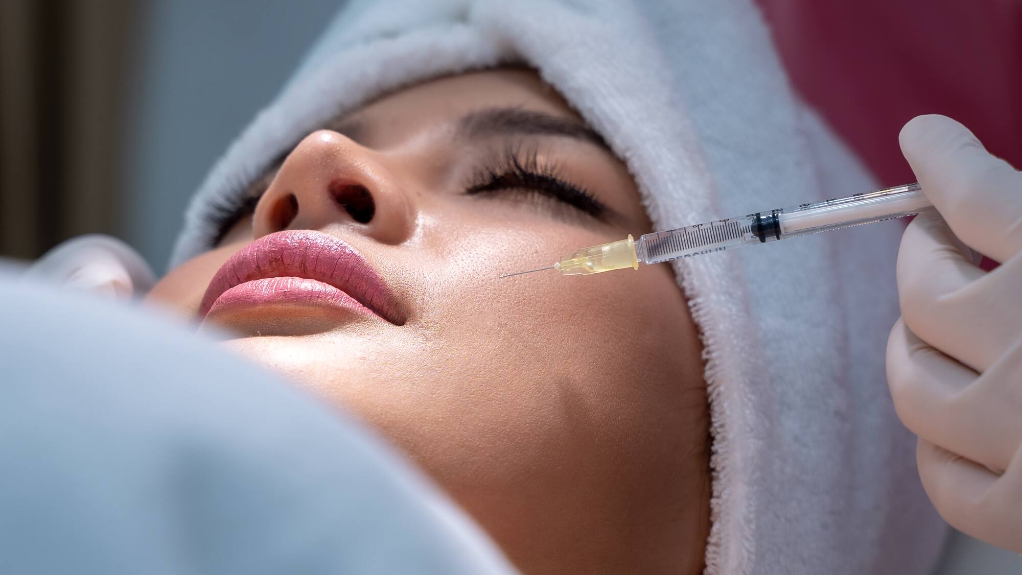 MY AESTHETICS – Lippen Aufspritzen Nürnberg mit modernster Technik